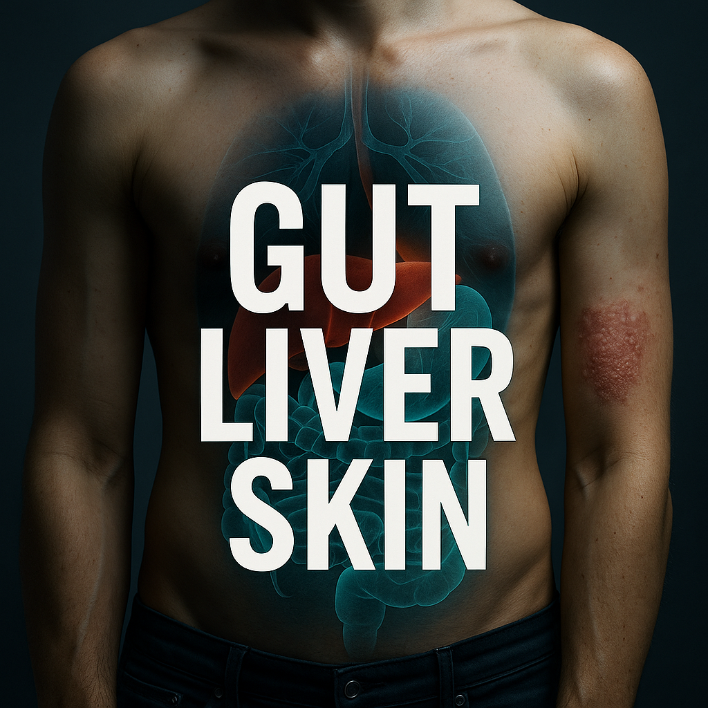 The Gut–Liver–Skin Axis: Why Psoriasis May Start in Your Intestines 🧠➡️🧪➡️🩺➡️🧴